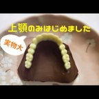 作品義歯チョコ(実物大 上顎のみ) シリコンモールド 入れ歯チョコ