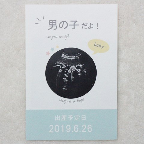 赤ちゃんの性別発表カード💐/エコー写真フレーム  ジェンダーリビール  メッセージカード